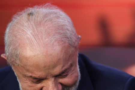 Presidente Lula passa por cirurgia para retirada de lesão no couro cabeludo