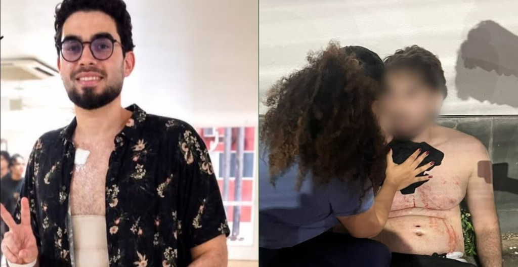 Estudante baleado em tentativa de assalto recebe alta após 12 dias internado